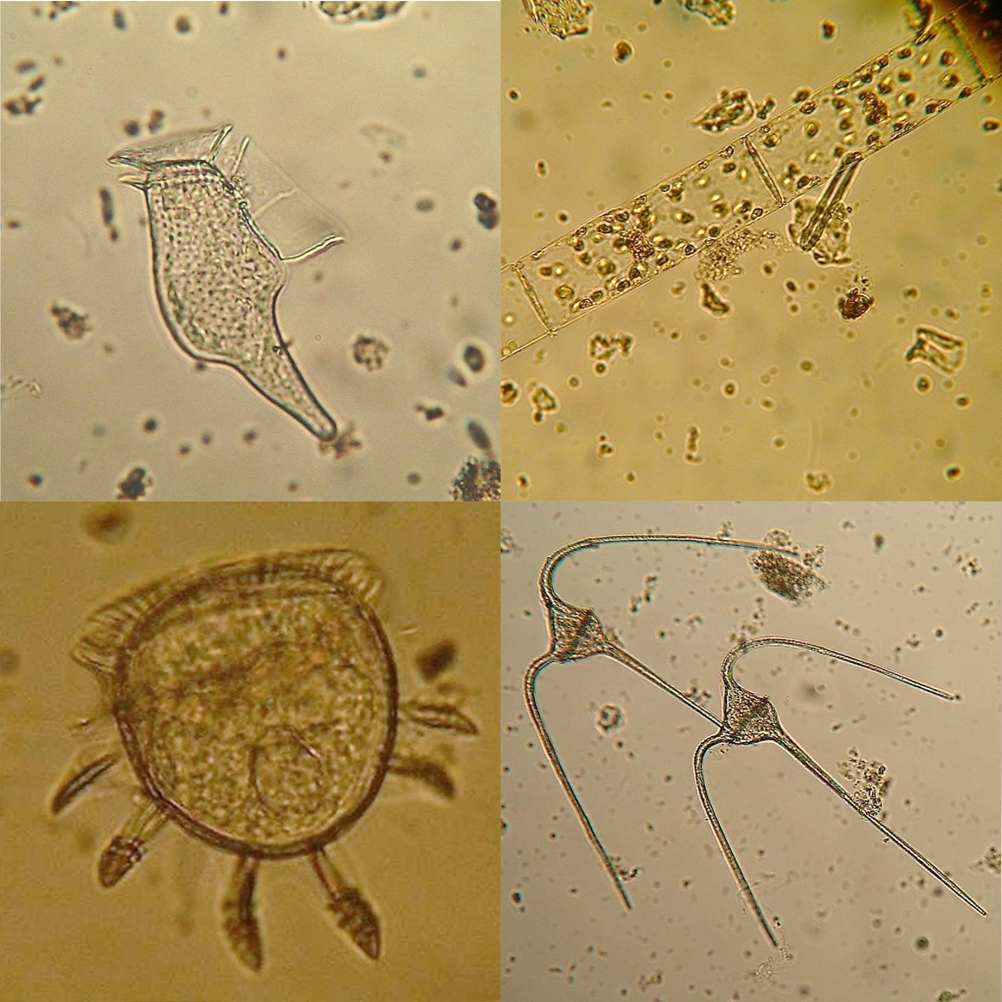Muestras de fitoplancton recogidas durante el programa de observación RADIALES. Foto: Joaquín Valencia.